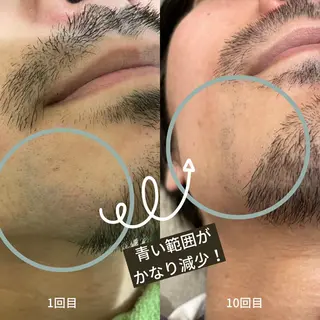 DUPE&MORE 店長kanaeのエステ・リラクイメージ