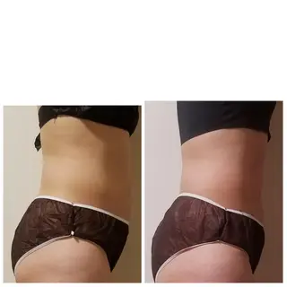 Marvelous K所属・杉山 恵子のエステ・リラクイメージ