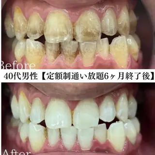 メンズ セルフホワイトニング WHITE福岡天神店のエステ・リラクイメージ