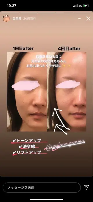 emiluca🫧 中須のエステ・リラクイメージ