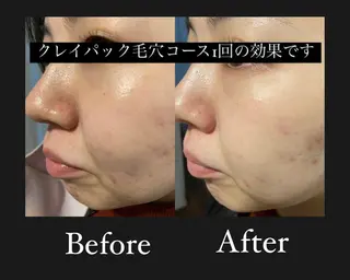 よもぎ蒸し専門店 Artemisiaのエステ・リラクイメージ