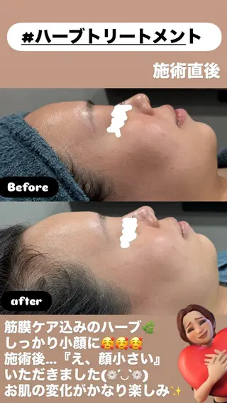 LiZA エステティックサロンのエステ・リラクイメージ