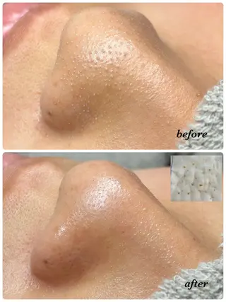 肌質改善Mbelle 越谷レイクタウン🌿のエステ・リラクイメージ