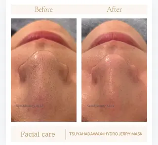 艶肌ワックス ALLY.のエステ・リラクイメージ