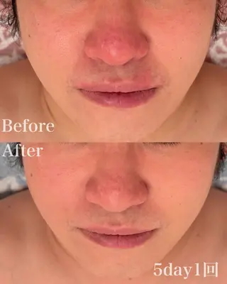 グリーンピール専門店 サロンY【大阪】のエステ・リラクイメージ