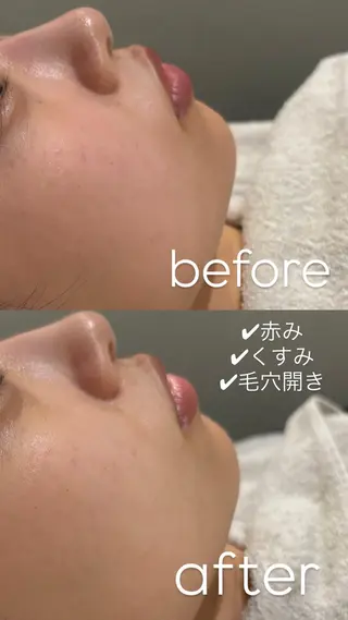 【vidyto】ヴィディトゥ所属・肌管理サロン vidyto　MOEのエステ・リラクイメージ