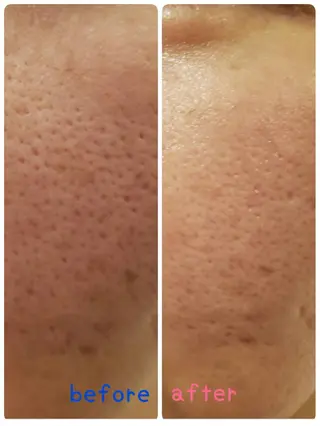 HappIness 遠赤外線ドームのエステ・リラクイメージ