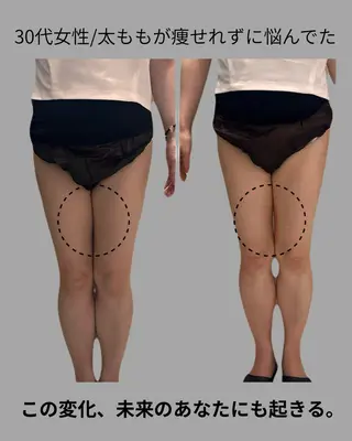 【脂肪冷却痩身サロン】una.福岡所属・UNA 福岡のエステ・リラクイメージ