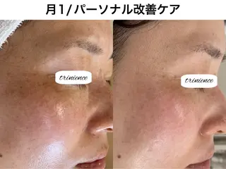 TRINIENCE 南流山店のエステ・リラクイメージ