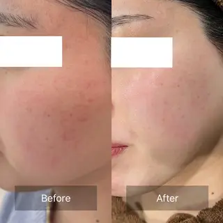 De'Im福井店所属・【福井シェアサロン】 青木優奈のエステ・リラクイメージ