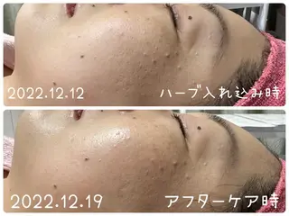 デトックス専門サロン ココシュエットのエステ・リラクイメージ