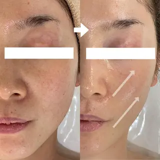 ニキビ・毛穴・ フェイシャル専門店のエステ・リラクイメージ