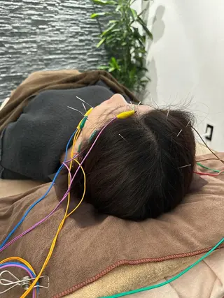 小顔矯/美容鍼/鍼灸 BeauJuのその他イメージ