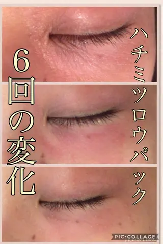 ニキビ・肌質改善専門 ♡人生が変わるサロンのエステ・リラクイメージ