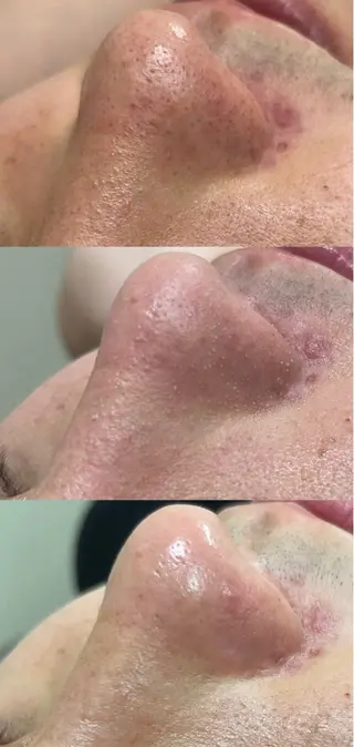 EPIL risaのマツエク・マツパデザイン