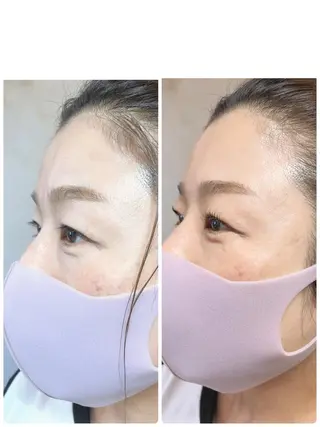 マツエク・マツパ marieanne まつ毛パーマ＆脱毛のマツエク・マツパデザイン