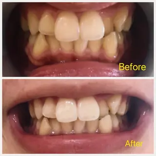 Ｍ渋谷 ホワイトニングのエステ・リラクイメージ