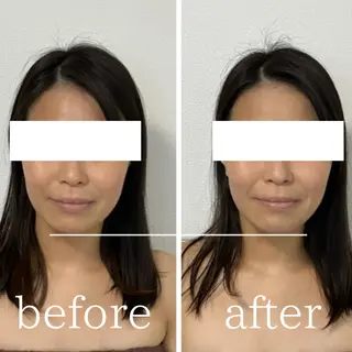 毛穴肌質ケアサロン Yourmeユアミーのエステ・リラクイメージ
