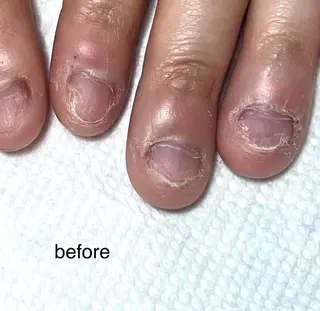 ネイル 【爪の育成専門】深爪・むしり癖・丸い爪・ガサガサなど　　Rio nail所属・Rio nail まなみのネイルデザイン