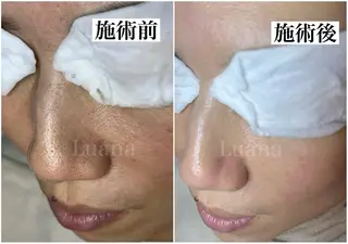 マツヤニWax専門/ 岸和田/Luanaのエステ・リラクイメージ