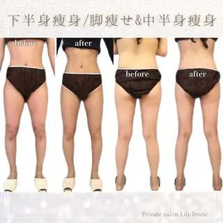 Lily branc 痩身/小顔/肌質改善のエステ・リラクイメージ