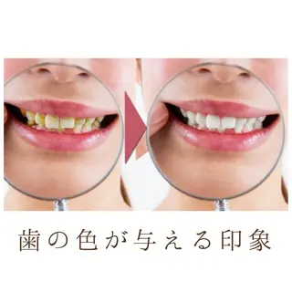 ホワイトニング ショップ津店のその他イメージ