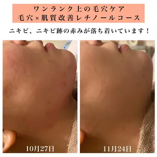 Bellesthe （ベルエステ）のエステ・リラクイメージ