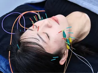 小顔矯正・美容鍼 FLOW鍼灸整体院のエステ・リラクイメージ