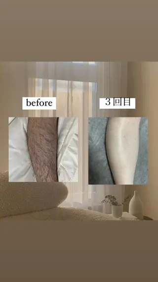 【韓国肌管理・脱毛】 クレセントのその他イメージ