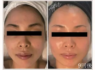 MYubelle ミューベルのエステ・リラクイメージ