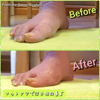 メンズ 足トラブル専門 ニコルル金沢のエステ・リラクイメージ