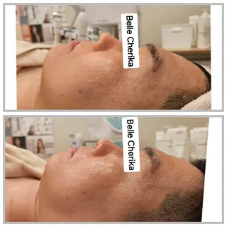 ベル チェリカ 三城のエステ・リラクイメージ