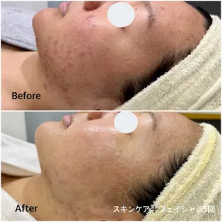 産後/ツヤ肌/子連れ /保育士在籍サロンのエステ・リラクイメージ