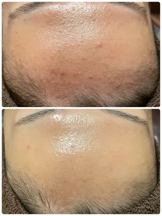 ルタンリッシュ さいたま店のエステ・リラクイメージ