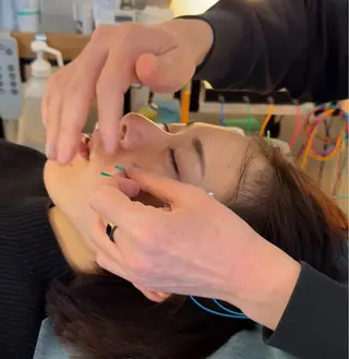 渋谷 小顔美容鍼 専門サロン YZのエステ・リラクイメージ