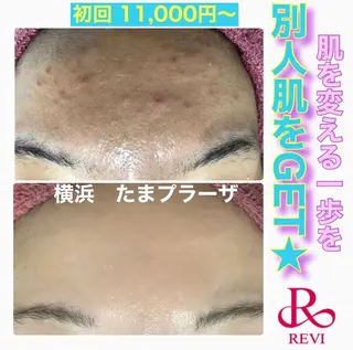 LILIANA ☆YURIのエステ・リラクイメージ