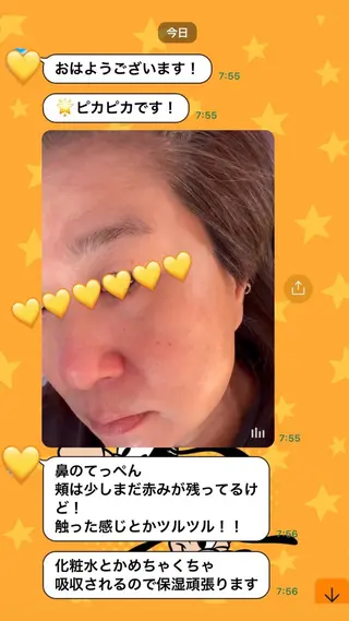 yellow💛【 脱毛&フェイシャル】のエステ・リラクイメージ