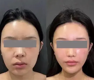 アイブロウ aliaハーブ水光店 エステティシャン募集のエステ・リラクイメージ