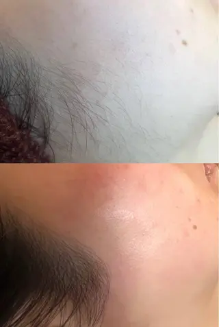 艶肌wax®︎ shocoのエステ・リラクイメージ