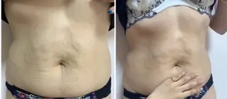 aliaハーブ水光店 エステティシャン募集のエステ・リラクイメージ