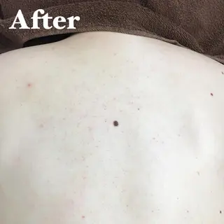 MIMI 吉祥寺2号店のエステ・リラクイメージ