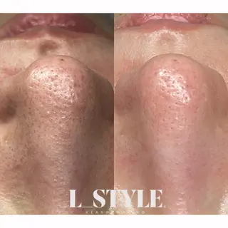 【L_style.】 エルスタイルのエステ・リラクイメージ