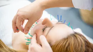 マッツンの 鍼のその他イメージ