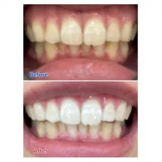 Ｍ渋谷 ホワイトニングのエステ・リラクイメージ