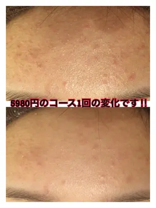 ショート カラー パーマ ヘアアレンジ メンズ キッズ ネイル マツエク・マツパ ニキビ・肌質改善専門 ♡人生が変わるサロンのエステ・リラクイメージ