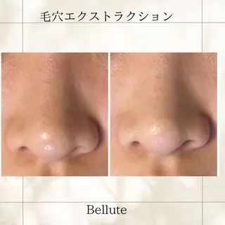 ピーリング専門店 Belluteのエステ・リラクイメージ