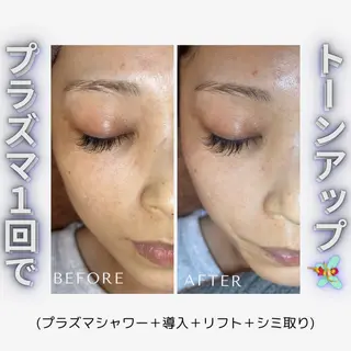 earth龍ヶ崎/ 脱毛/シミ取り🆕のエステ・リラクイメージ