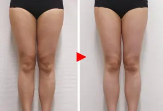 メンズ キッズ ホワイトニングサロン プレジールのエステ・リラクイメージ