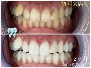 札幌ホワイトニング ラディアンス菊水店のその他イメージ