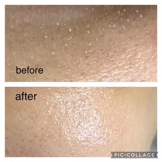 NAO 🌺のマツエク・マツパデザイン